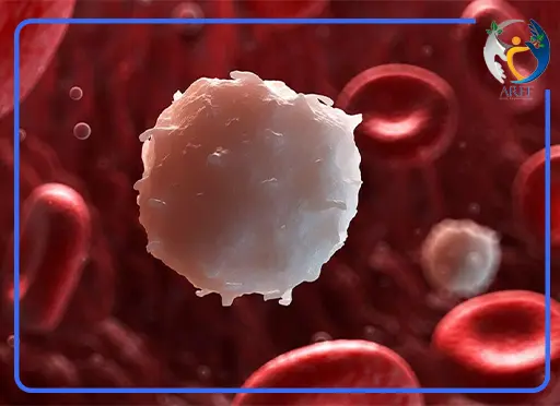 لوسمی میلوژن حاد